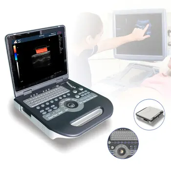 S3800 aparat cu ultrasunete portabil prețurile de ecograf mindray aparat cu ultrasunete