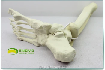 ENOVO interventii chirurgicale Ortopedice fost efectuate pentru a simula os model de Sawbone os artificial model